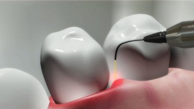 Photo of Benefits of Laser Dentistry
