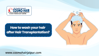 Photo of How to wash your hair after Hair transplantation?