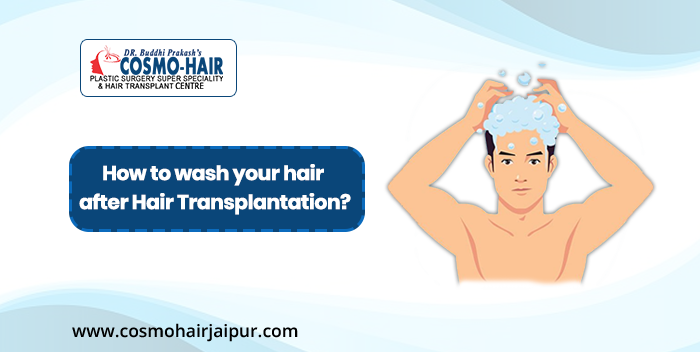 wash your hair after Hair transplantation