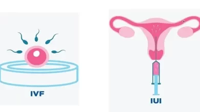 Photo of What queries do people have in their mind while going for IVF or IUI treatment?