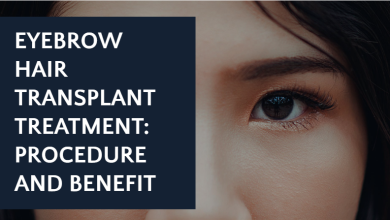 Photo of Eyebrow Hair Transplant Treatment: Procedure and Benefit