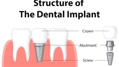 Photo of 5 Tips for Teeth Whitening with Crowns